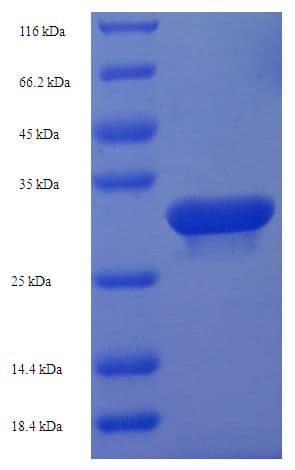 Human HDDC3 Protein (Recombinant His-SUMO)