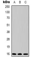 BIRC5 / Survivin Antibody
