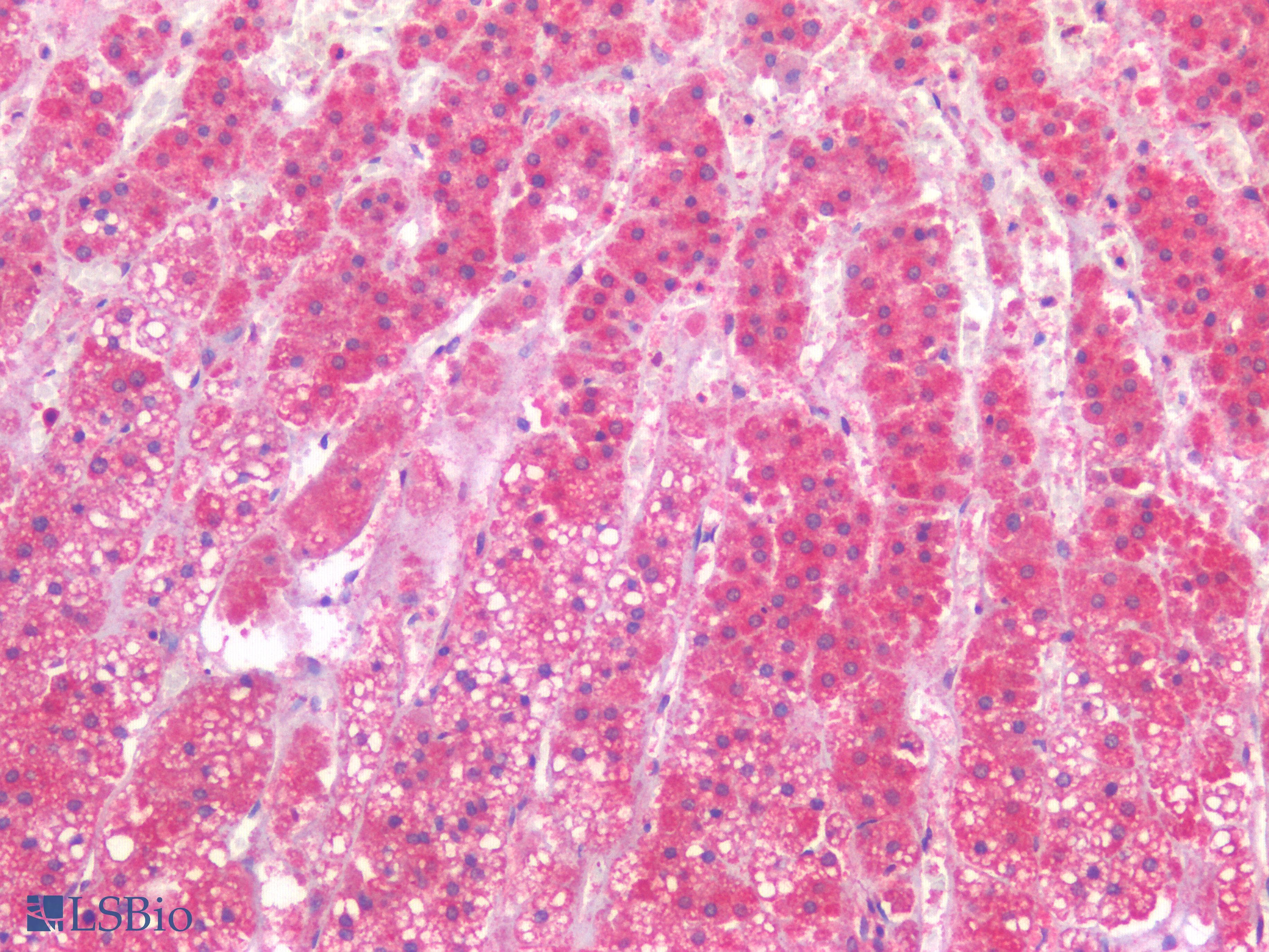PathPlus™ Polyclonal Rabbit anti-Human HAVCR1 / KIM-1 Antibody (IHC)