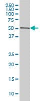Monoclonal Mouse anti-Human CDK8 Antibody (clone 6H5, WB)