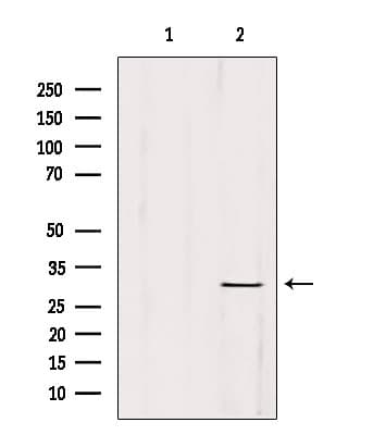 Polyclonal Rabbit anti-Human ETFA Antibody (IHC, IF, WB)