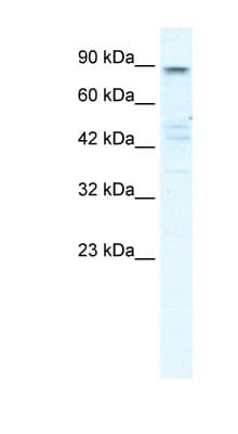 KCNQ2 Antibody (aa154-203)