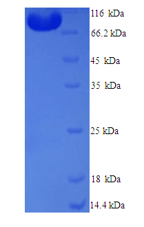 Human MTRR Protein (Recombinant His)