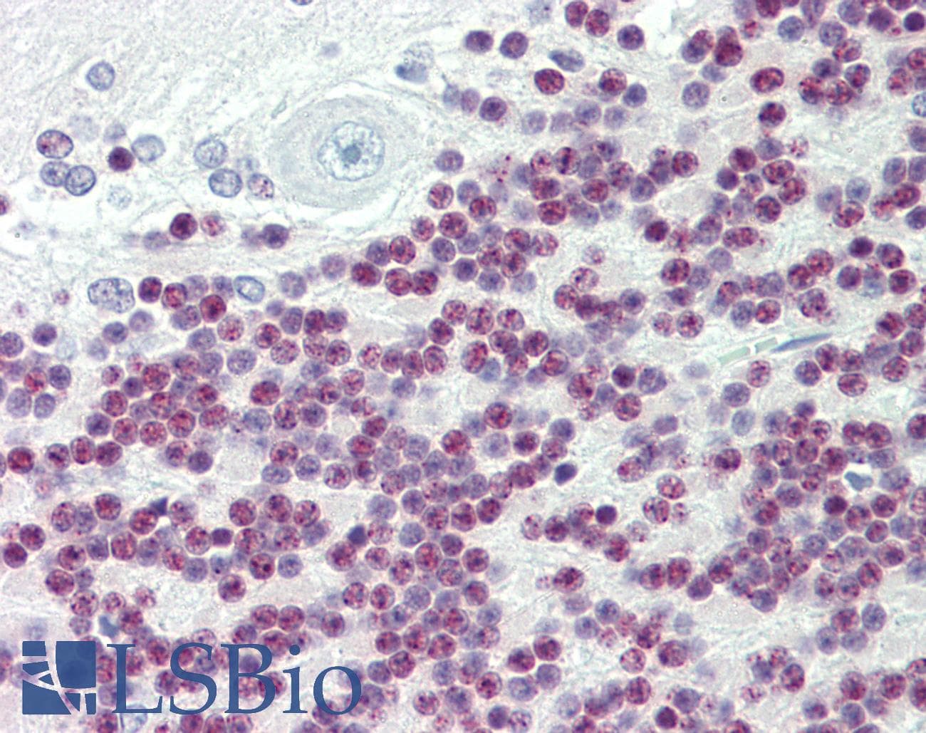 Polyclonal Rabbit anti-Human TBX15 Antibody (aa412-461, IHC, WB)