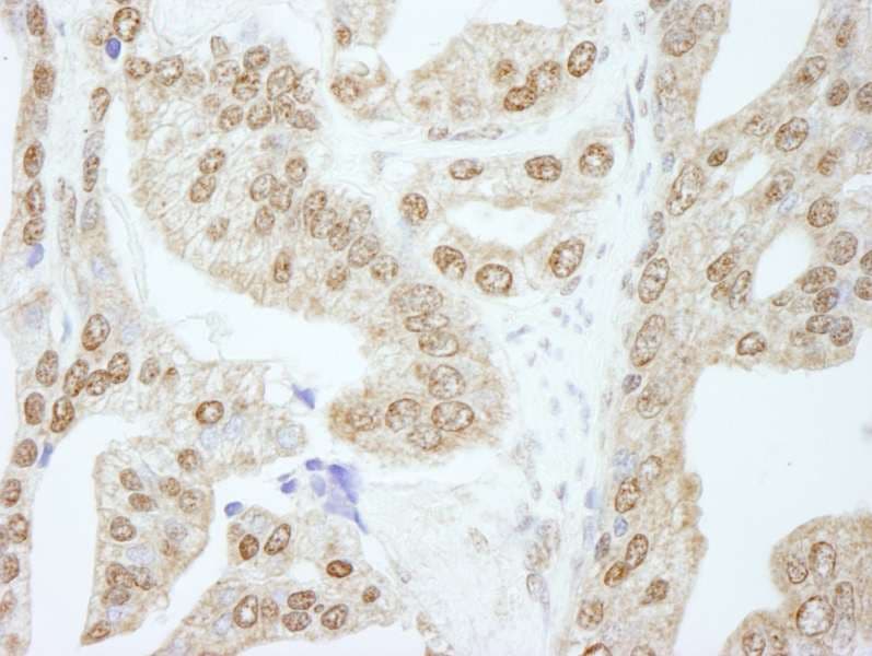 CCNE1 / Cyclin E1 Antibody (aa360-410)