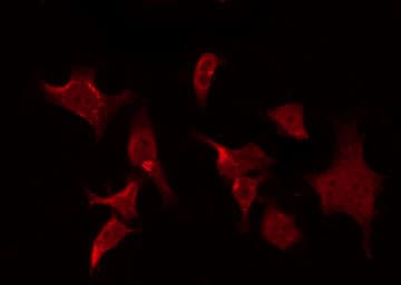 Polyclonal Rabbit anti-Human SIRT2 / Sirtuin 2 Antibody (IF, WB)