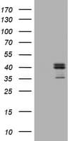 FCER2 / CD23 Antibody (clone OTI7C9)