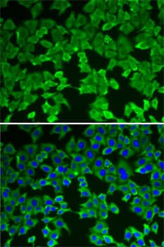 MTAP Antibody