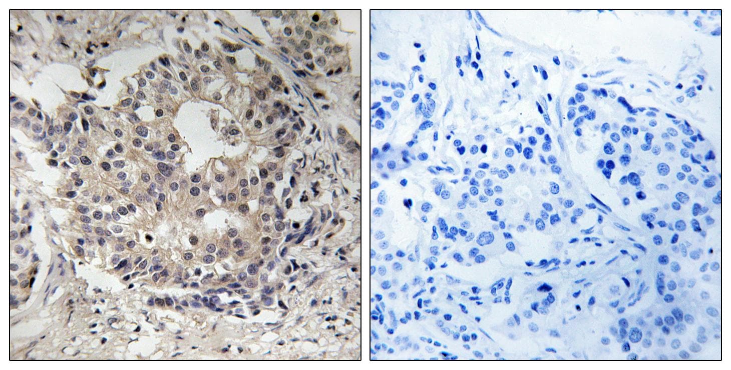 Polyclonal Rabbit anti-Human RPS6 / Ribosomal Protein S6 Antibody (phospho-Ser235+Ser236, IHC, WB)