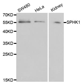 SPHK / SPHK1 Antibody