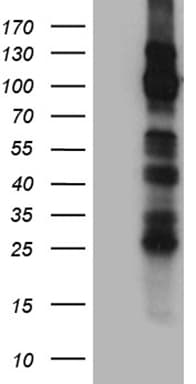 TRPM8 Antibody (aa1-300, clone OTI7A11, Carrier-free)