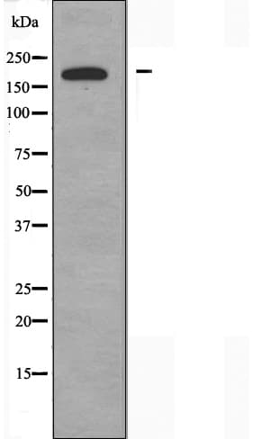 RALGAPA2 Antibody