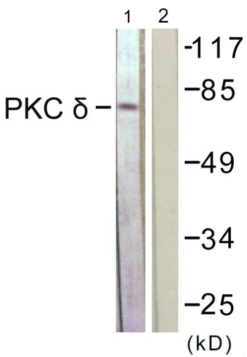 PRKCD / PKC-Delta Antibody (p505)