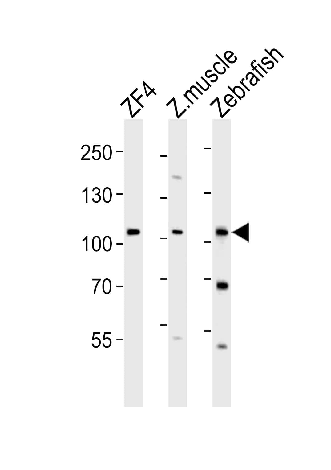 agbl2 / zte25 Antibody (aa92-126)