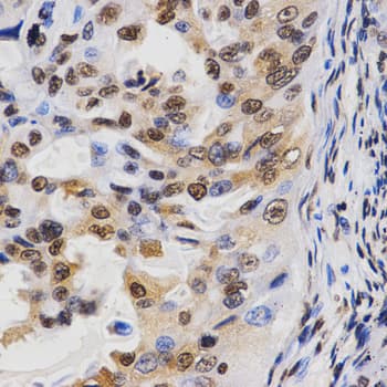 Polyclonal Rabbit anti-Human Histone H3 Antibody (Tri-Methyl-Lys36, IHC, IF, WB)