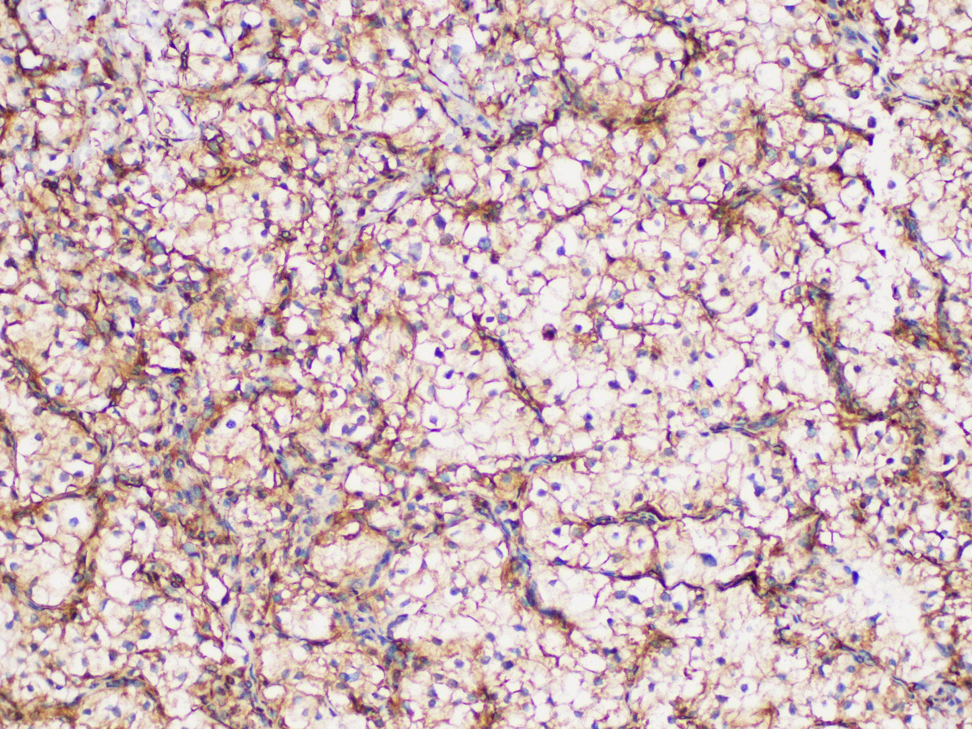 GPNMB / Osteoactivin Antibody