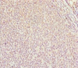 DDX11 / CHLR1 Antibody