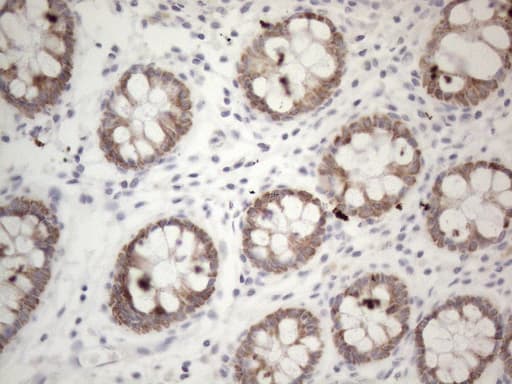 PD-L2 / PDCD1LG2 / CD273 Antibody (clone OTI6C3, Carrier-free)