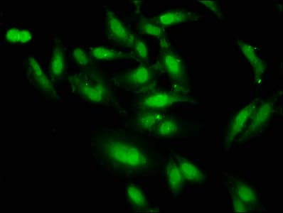 DLX1 Antibody