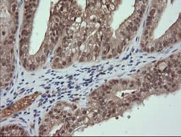 TRMT2A Antibody (clone OTI2C6)