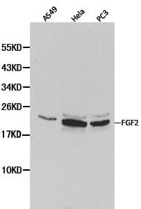 Polyclonal Rabbit anti-Human FGF2 / Basic FGF Antibody (IHC, WB)