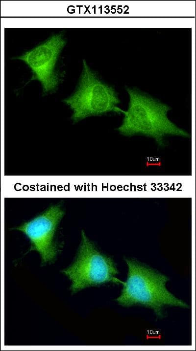 SPR Antibody (aa65-261)