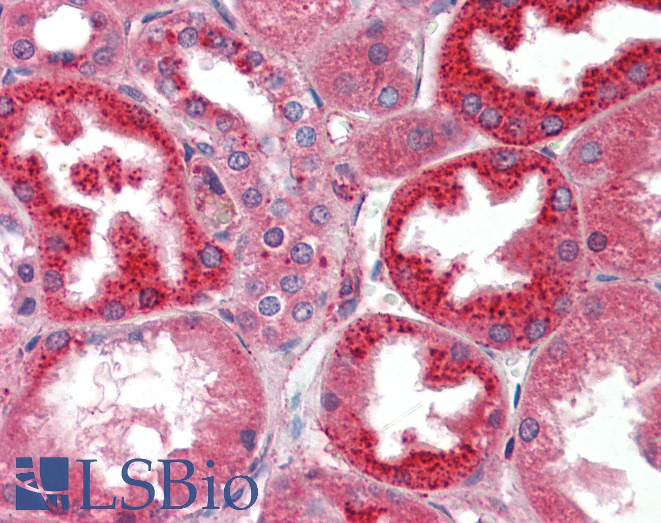 IHC-plus™ CTSL / Cathepsin L Antibody