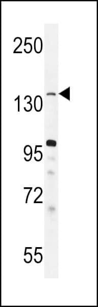 KDM3B / JMJD1B Antibody (aa1328-1358)