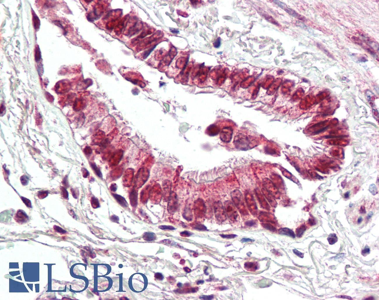 Polyclonal Rabbit anti-Human BECN1 / Beclin-1 Antibody (IHC, IF, WB)