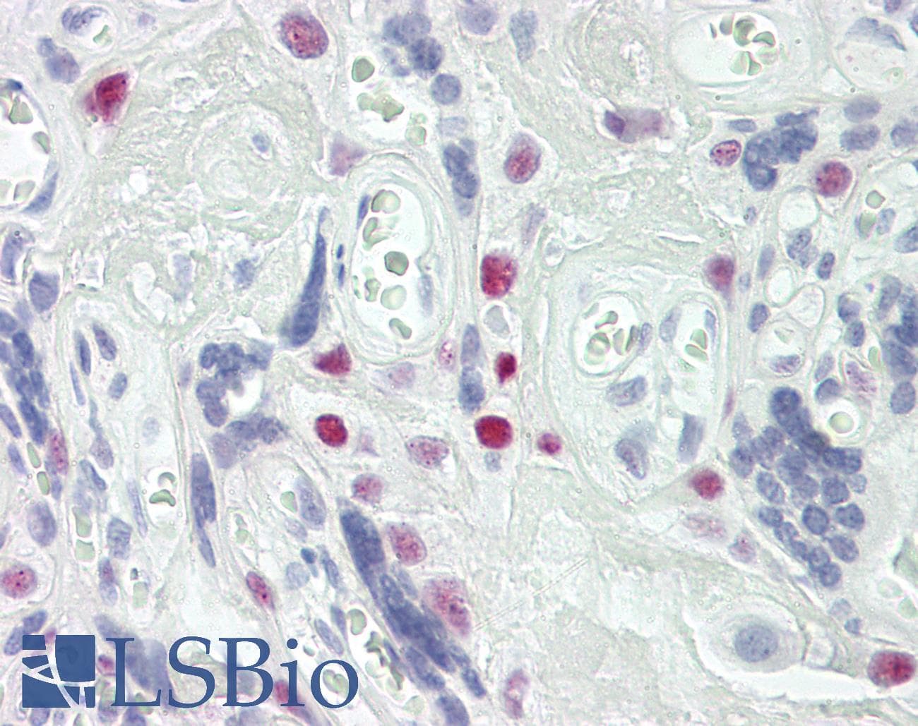 IHC-plus™ TCEAL4 Antibody (aa166-215)