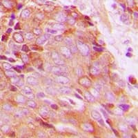 Polyclonal Rabbit anti-Human YWHAZ / 14-3-3 Zeta Antibody (C-Terminus, IHC, WB)