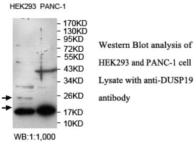 DUSP19 / SKRP1 Antibody (aa1-217)