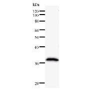 UBE2K / LIG Antibody (clone 757C3a)