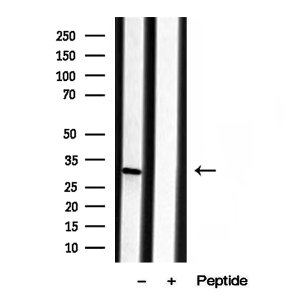 Polyclonal Rabbit anti-Human SCEH / ECHS1 Antibody (IHC, WB)