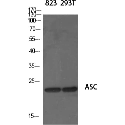PYCARD / ASC / TMS1 Antibody (10-90 aa, N-terminal)