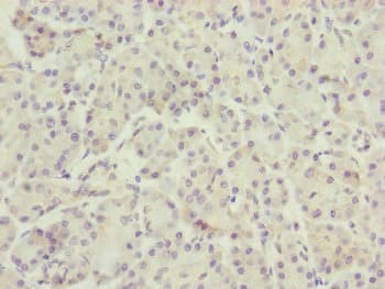 TTLL7 Antibody