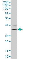 FCGR3A / CD16A Antibody (clone 2B11)