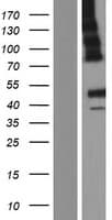 ABHD12 Protein (Over-Expression Lysate Myc-DDK (Flag))