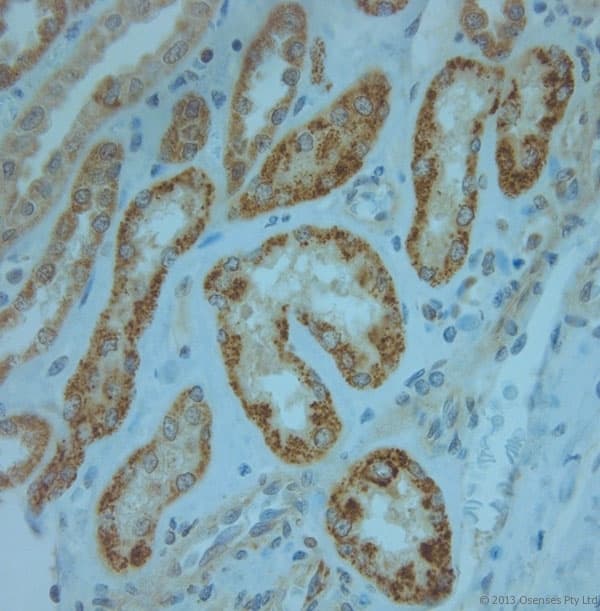 KCNJ13 / KIR7.1 Antibody (aa2-50)