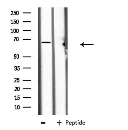 CES2 / Esterase Antibody