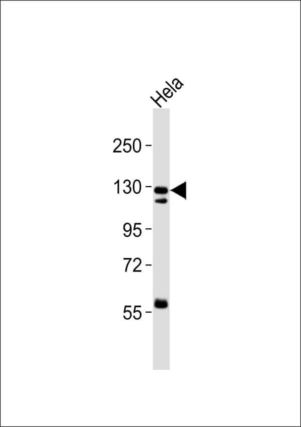 PC / Pyruvate Carboxylase Antibody