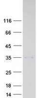 Human EDARADD Protein (Recombinant Myc-DDK (Flag))