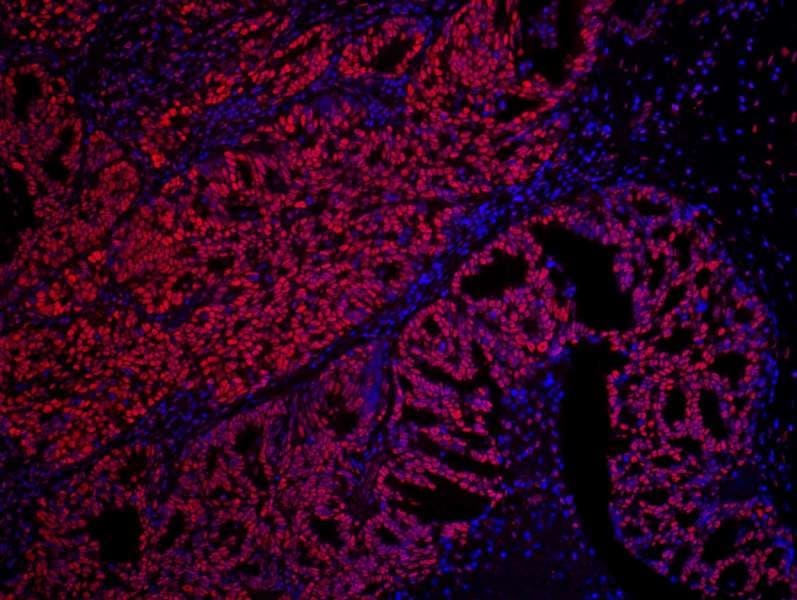 Polyclonal Rabbit anti-Human SET / TAF-I Antibody (aa125-175, IHC)