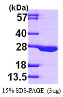 Human AK1 / Adenylate Kinase 1 Protein (Recombinant His)