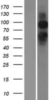 GRM6 / MGLUR6 Protein (Over-Expression Lysate Myc-DDK (Flag))