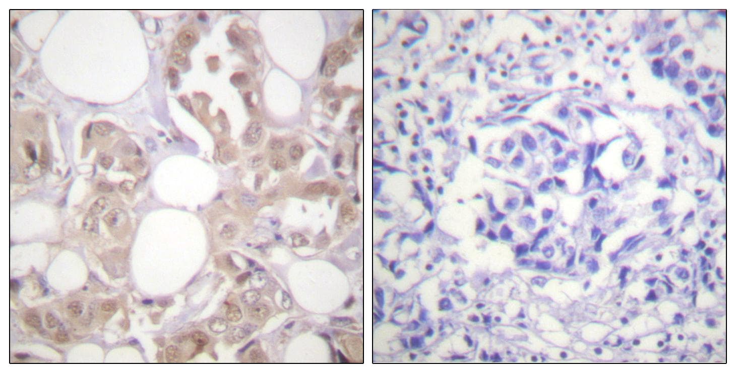 CDK7 Antibody (phospho-Thr170)