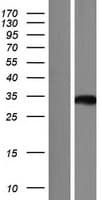 ASPDH Protein (Over-Expression Lysate Myc-DDK (Flag))