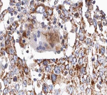 Polyclonal Rabbit anti-Human TGFB2 / TGF Beta2 Antibody (IHC, WB)