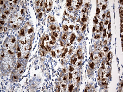 SLC9A1BP / CHP Antibody (clone OTI3H3)