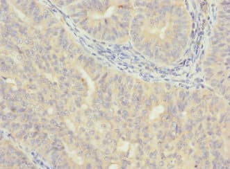 Polyclonal Rabbit anti-Human VHLL Antibody